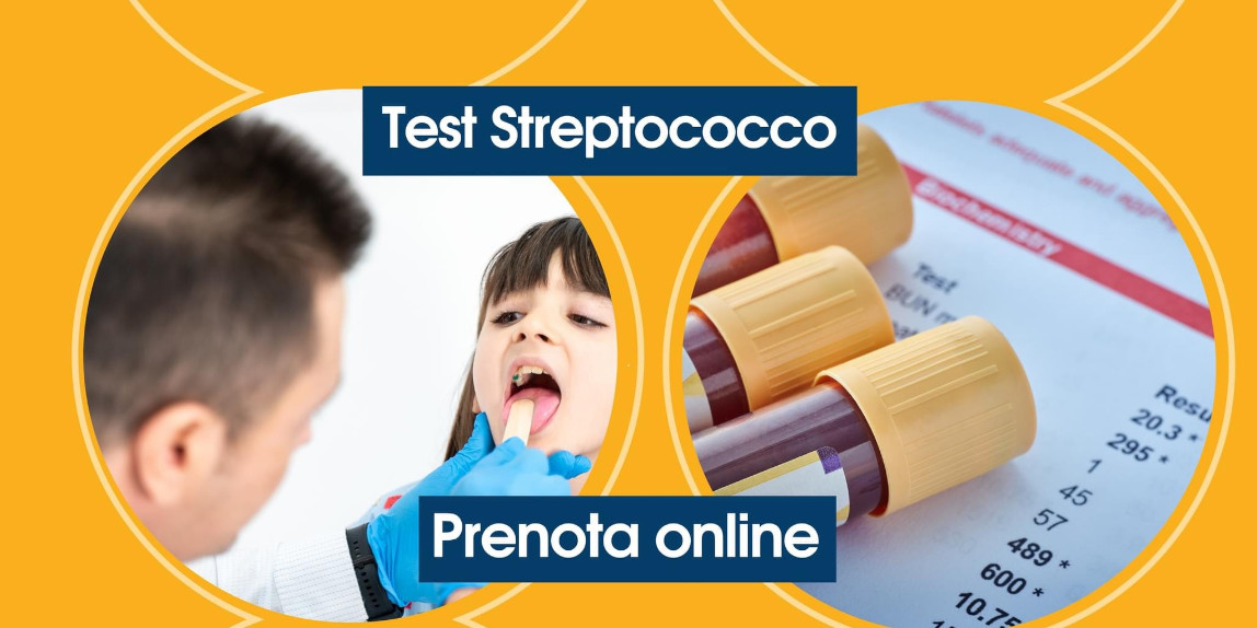 Test streptococco